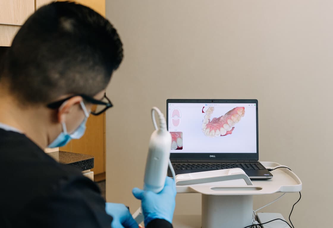 Dental Crowns In Sauganash, Edgebrook, Forest Glen, Chicago, IL